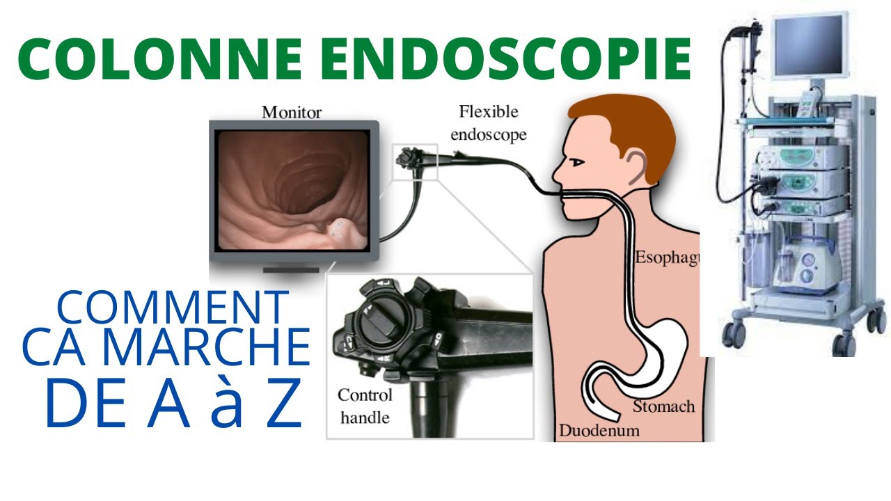 COLONNE ENDOSCOPIE: Principe de fonctionnement de A &agrave; Z