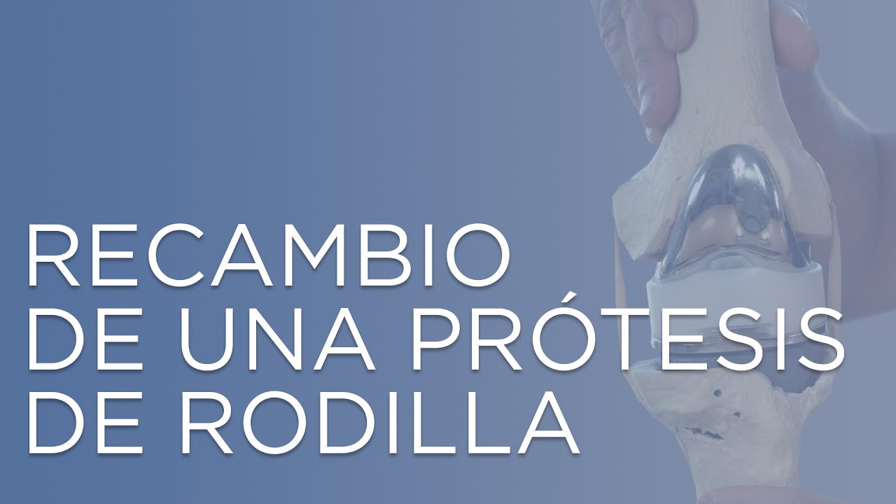 Recambio de una pr&oacute;tesis de rodilla  &iquest;Por qu&eacute; hay que cambiar la pr&oacute;tesis de rodilla?
