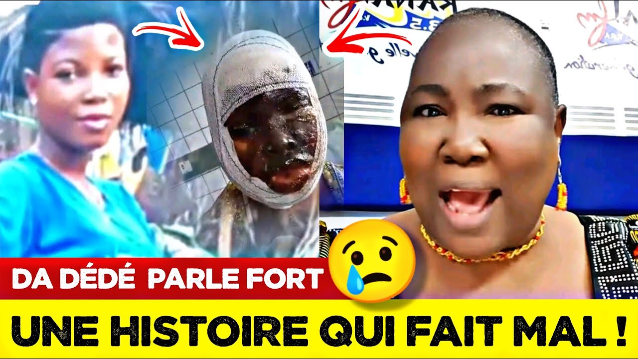 🚨DA DÉDÉ SE PRONONCE FORT SUR L’AFFAIRE DE LA FILLE BRÛLÉE À L’ACIDE PAR SA RIVALE 😭🔥🇹🇬