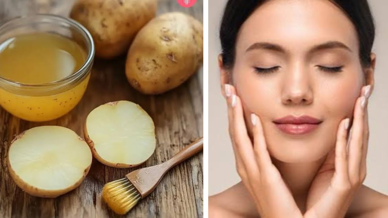 OMG 😮 This Facial Remove Your Dark Spots, Brown Spots, Pigmentation & Pimples in just 3 Days💯🥰