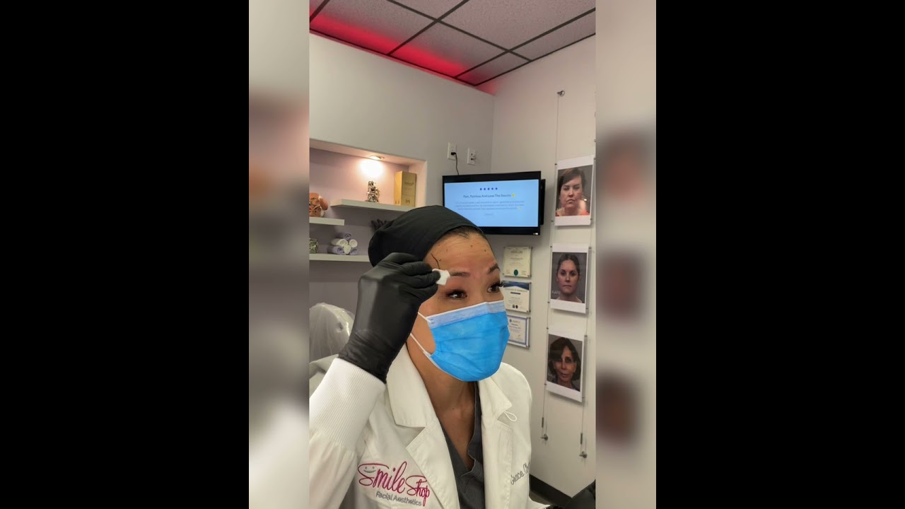 **FULL VIDEO** Botox Dosage and Injection Sites Explained. Botox on myself!