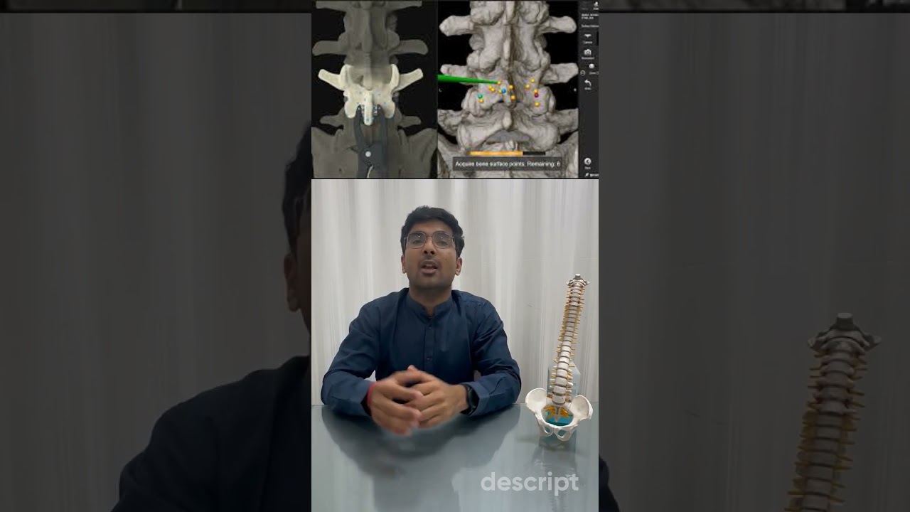🚀 Game-Changer in Spine Surgery! How Navigation Technology is Saving Lives 🏥💡 #backpainrelief