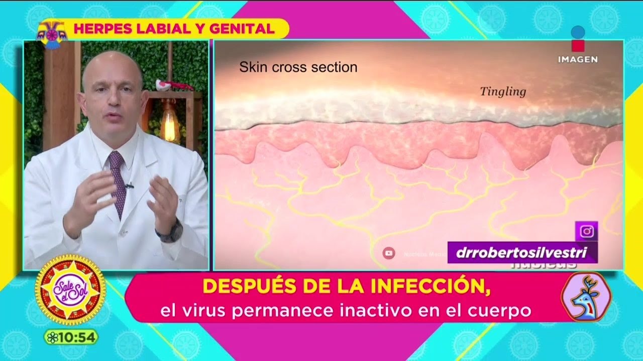 Herpes Genital: Qué es, cómo ataca, síntomas, tratamiento y más | Sale el Sol