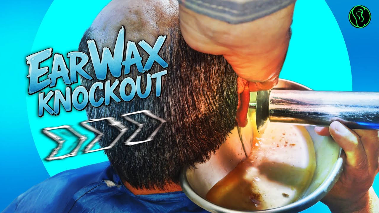 EarWax KnockOut | Best Ear Cleaning video #earwaxremoval #earwax #earwaxremoving