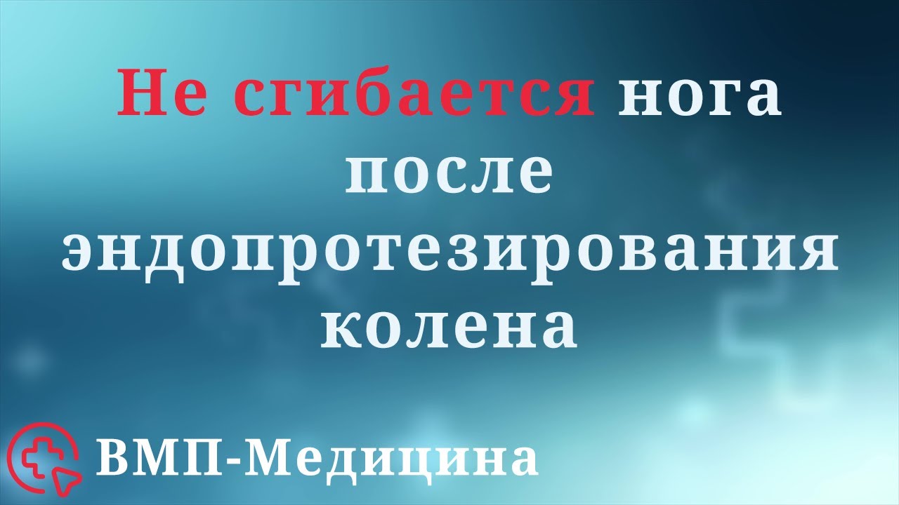 Не сгибается нога после эндопротезирования колена спустя 2 месяца | ВМП-Медицина
