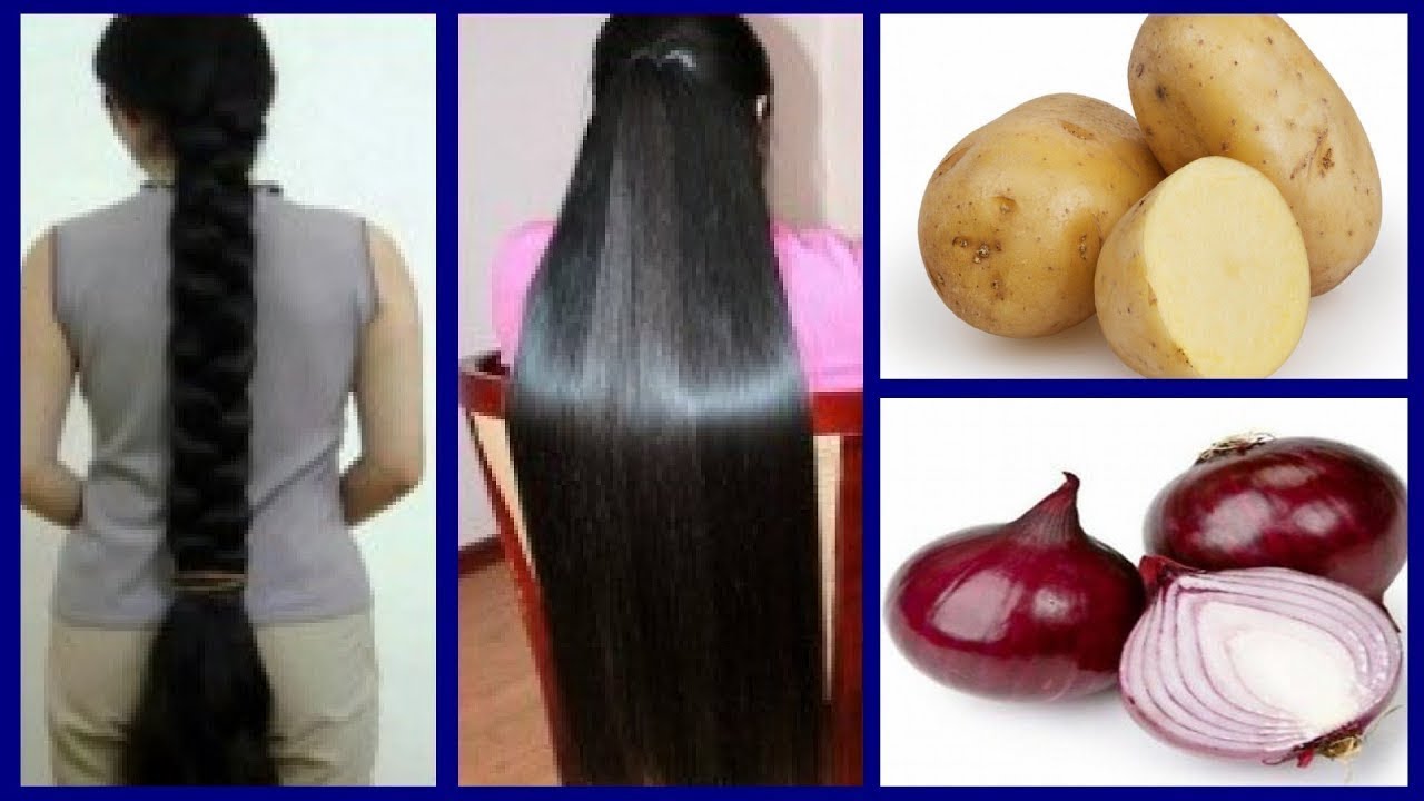How To Grow Long and Thicken Hair Faster With Onion & Potato !! Super Fast Hair Growth Challenge!