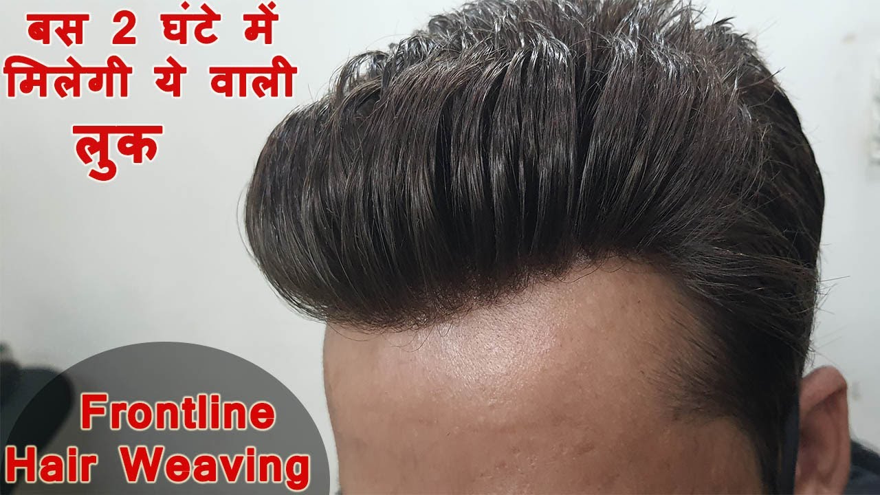 Hair Weaving in Delhi | Frontline Hair Weaving in Delhi | Cost of Hair Weaving for Men in Delhi