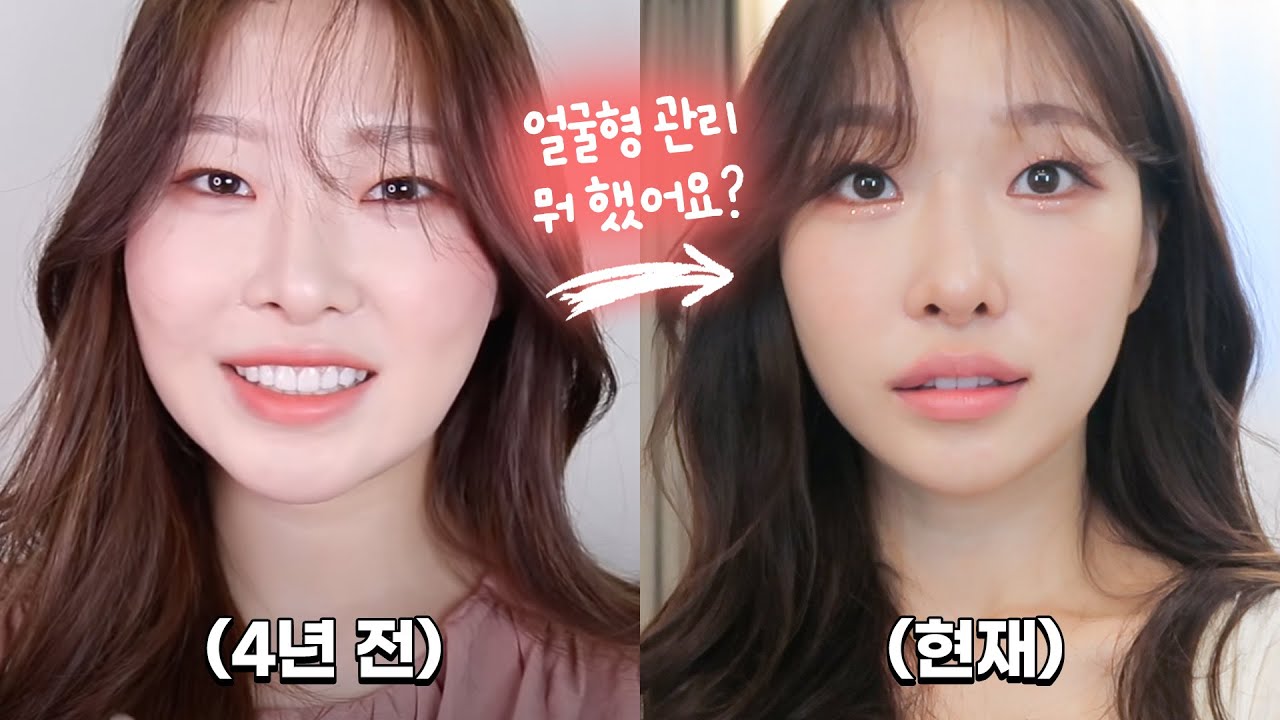 cc) 얼굴형관리 너 뭐 했어?😳수술없이 얼굴형예뻐지는법ㅣ시술,경락,홈케어 추천&비추천ㅣ아랑