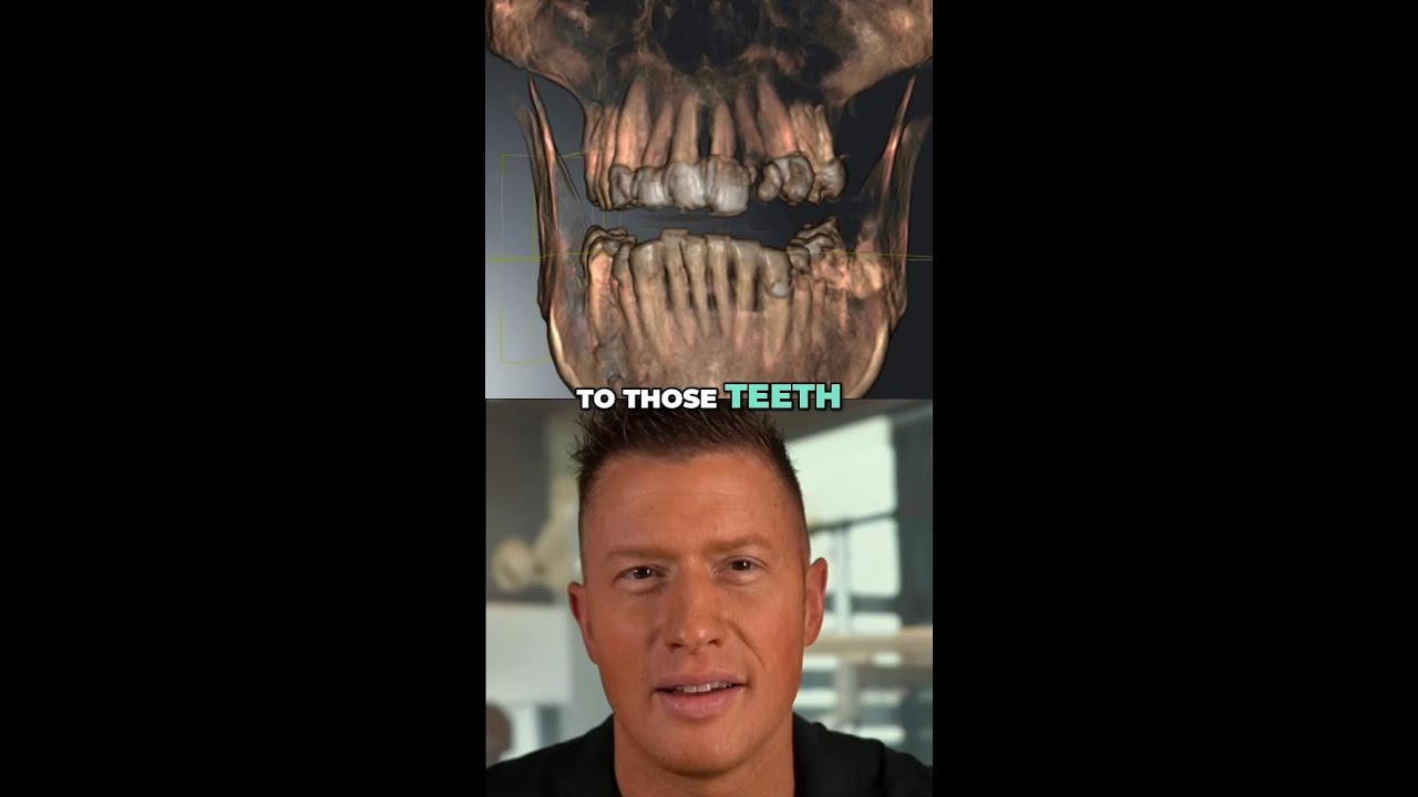 3D Imaging - The Future of Dental Restoration