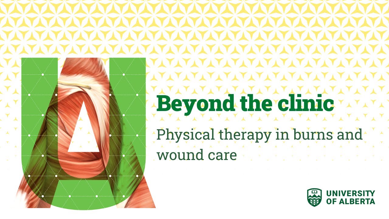 Beyond the clinic: Physical therapy in burns and wound care