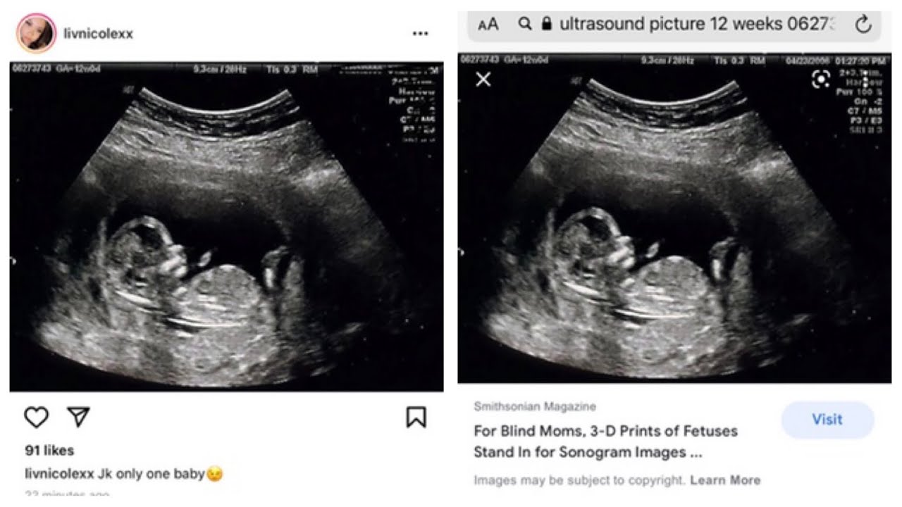 Liv&rsquo;s life. Fake baby , Fake ultrasound . Smh! Come on now sis this is beyond crazy. ￼