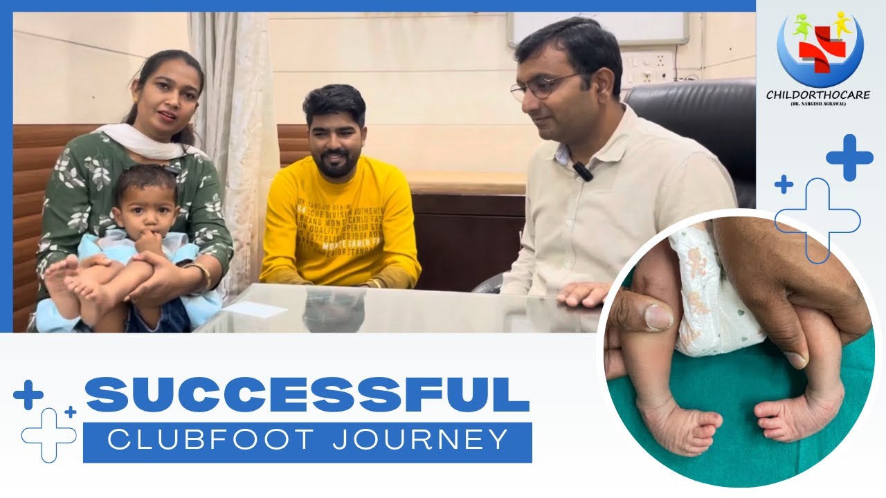 Successful Clubfoot treatment In Delhi ll  टेडे मेड़े पाँव का इलाज #clubfoot