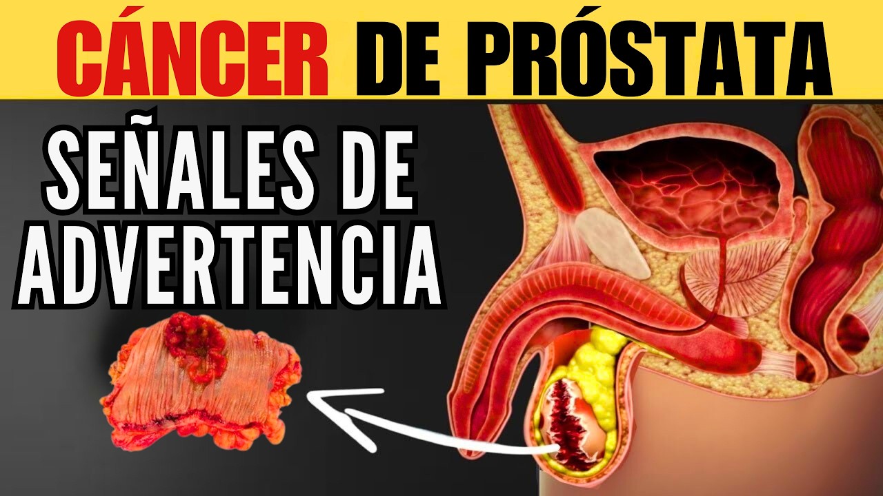 13 Señales Silenciosas Tempranas del Cáncer de Próstata (No Las Ignores)