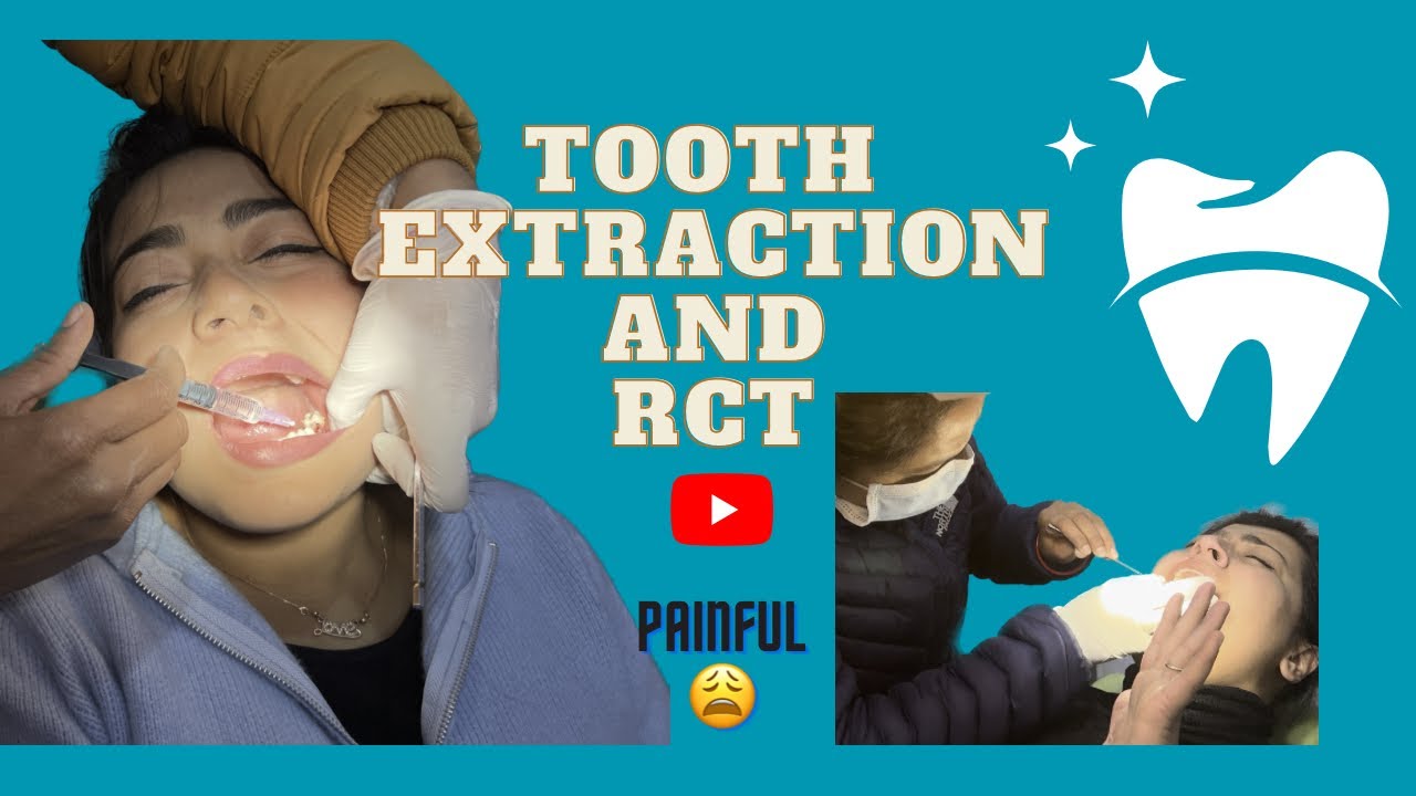 OMG 😳 Mera Tooth 🦷 Nikal Diya |Tooth Extraction and Root Canal Treatment 😭