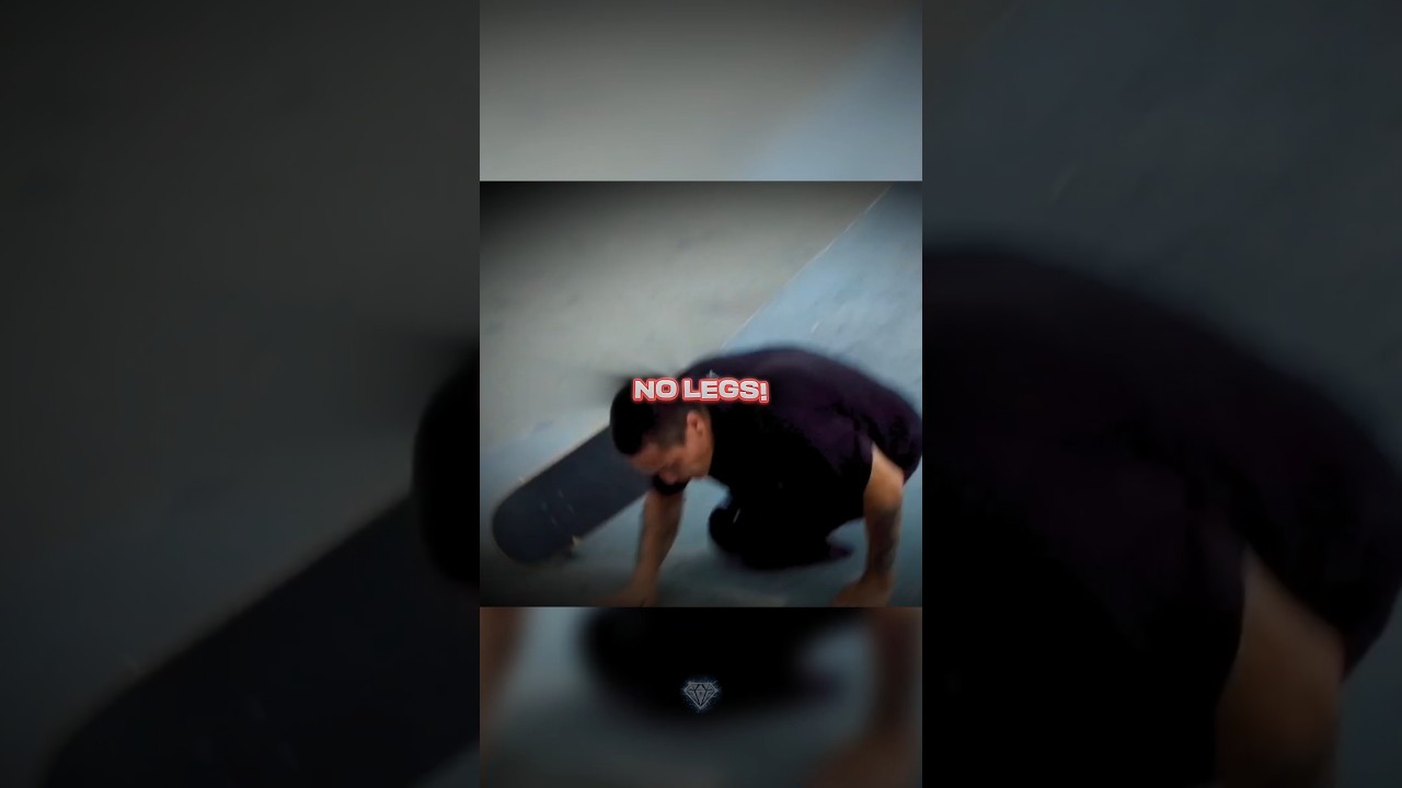 He Lost His Legs at 6... Then THIS Happened🤯