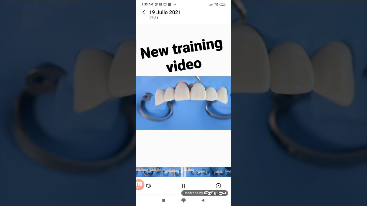 Aislamiento dental : Inversion Prt 2