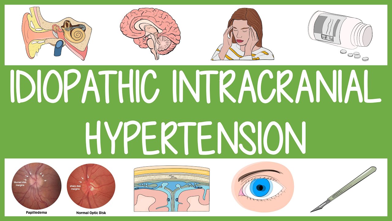 Idiopathic Intracranial Hypertension Visually Explained