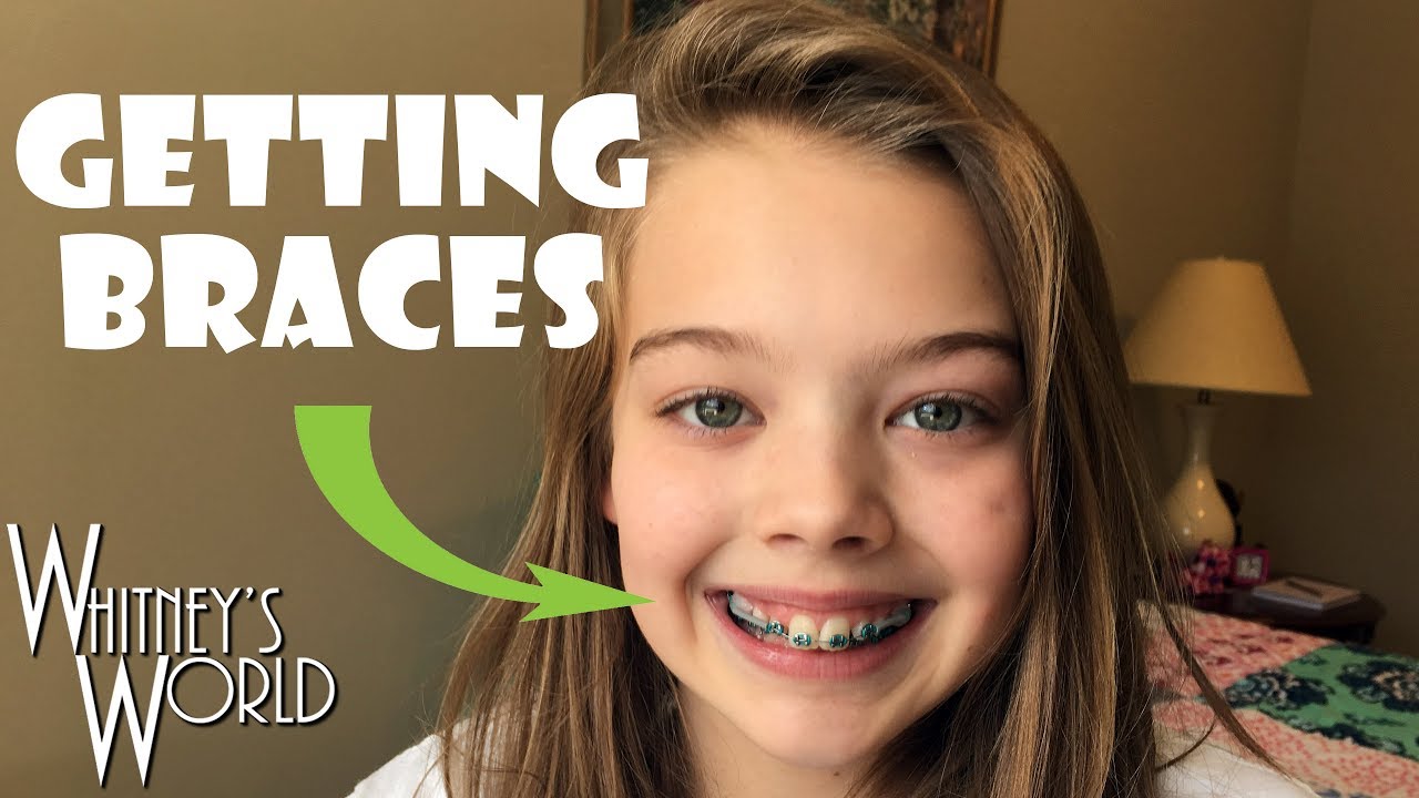 Getting Braces | Whitney Bjerken
