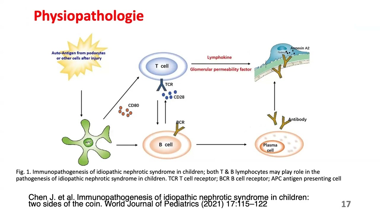 SYNDROME NEPHROTIQUE