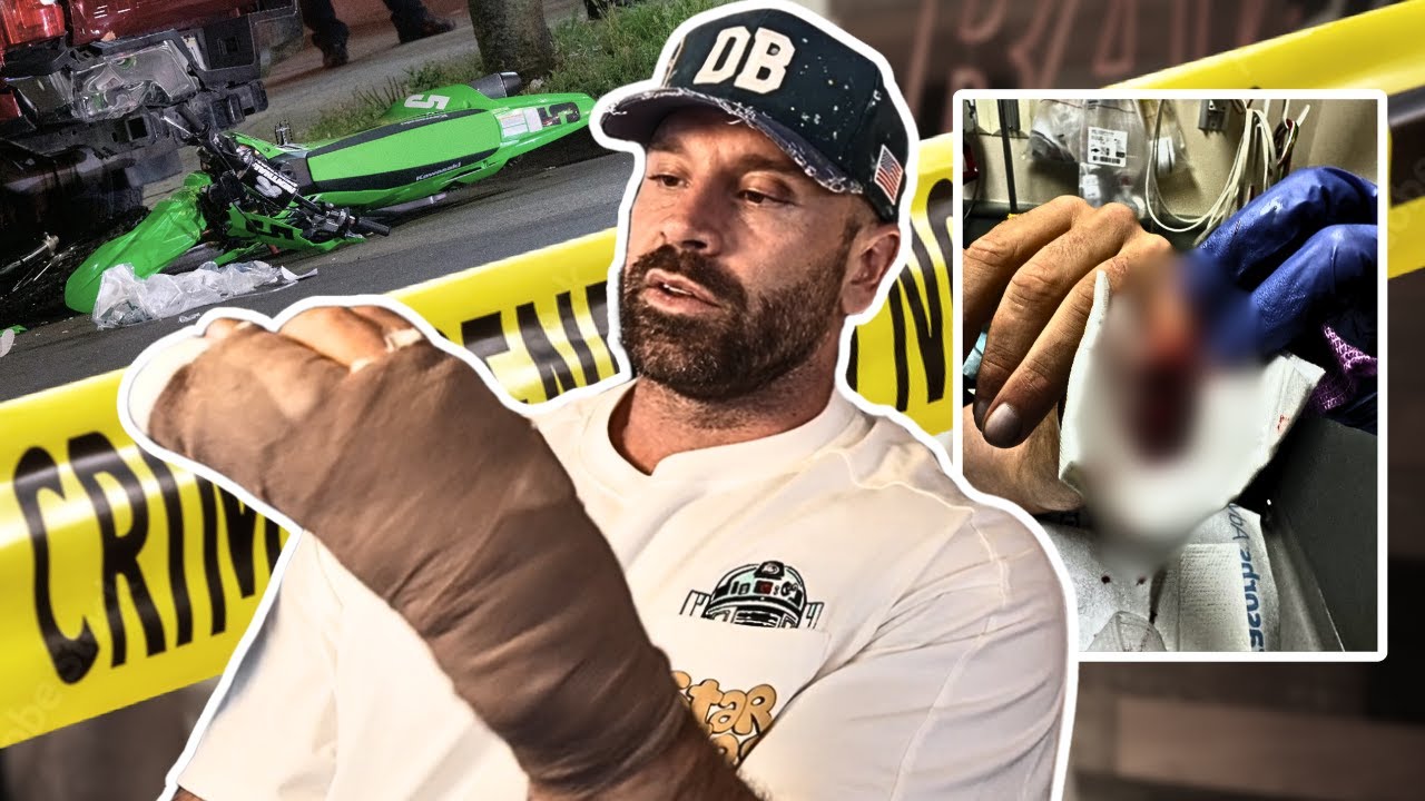 HOW I CUT MY PINKY OFF