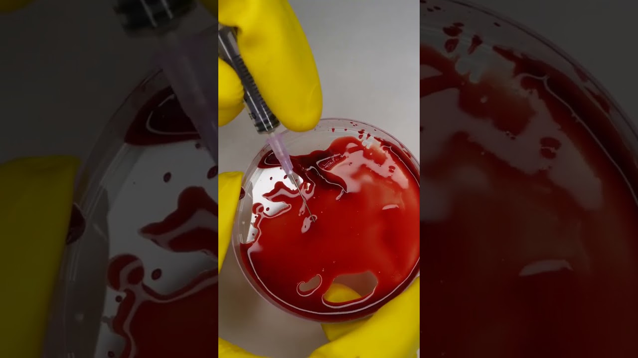 Snake Venom on human blood #shorts #bluebox
