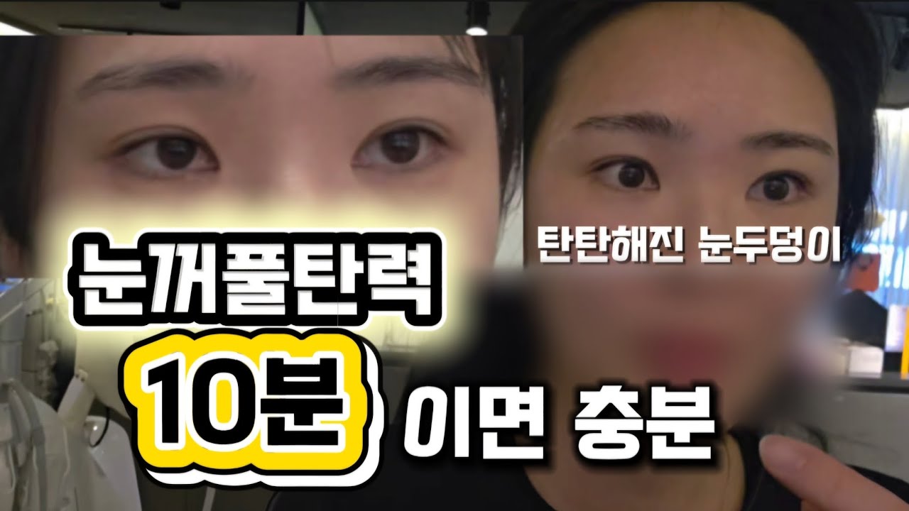 눈꺼풀탄력관리 써니100샷으로! 퀵-빠르게 생각보다 빠르게 달라집니다