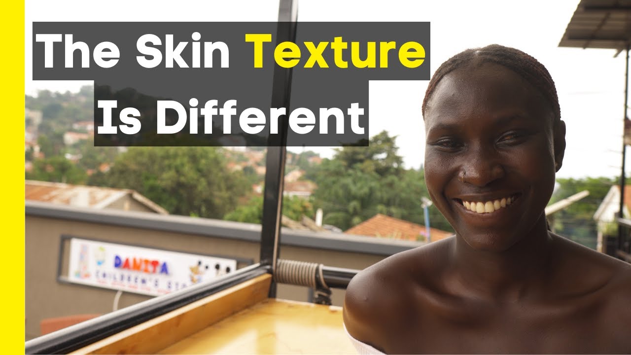 Shocking: What Ugandans Think About WHITE People