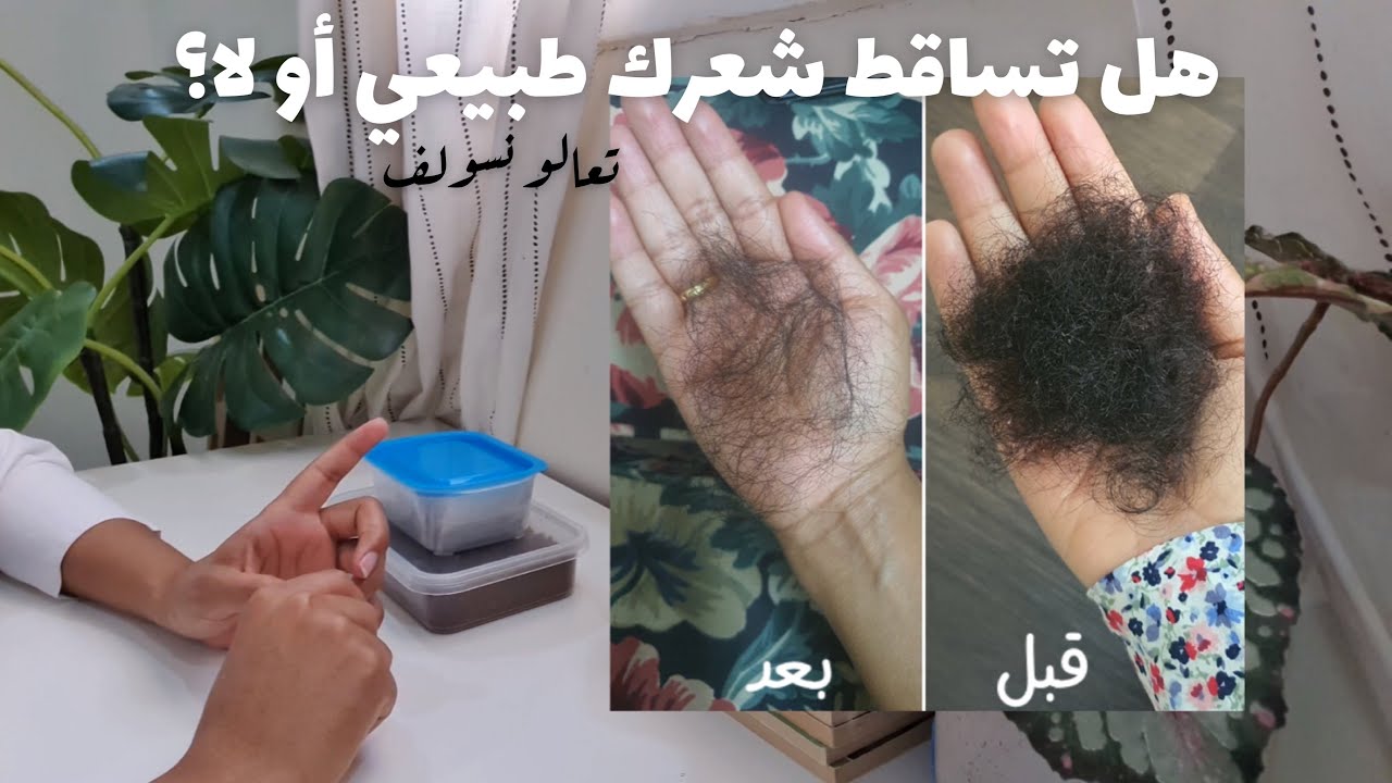 هل تساقط شعرك طبيعي أو لا | أفضل حل لتساقط الشعر بمكون واحد موجود في كل بيت + تجربتي