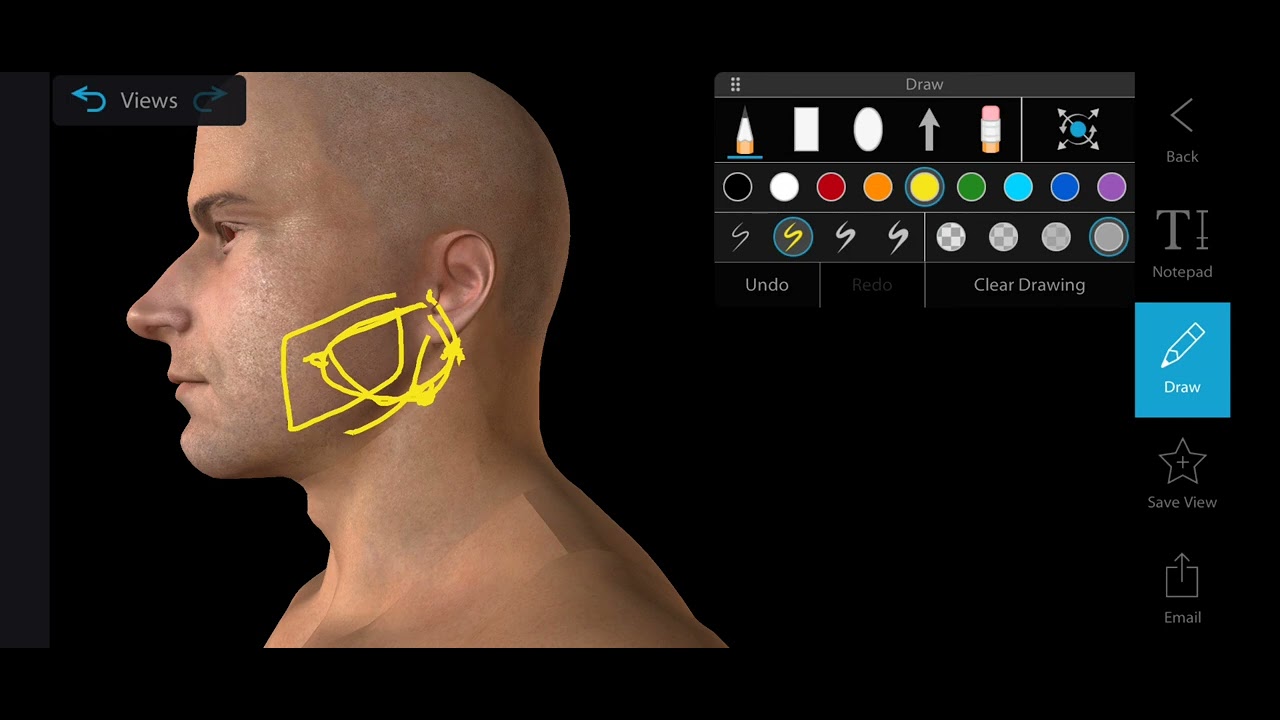 Surface Marking of Parotid Gland & Parotid Duct | Anatomy of Parotid Gland
