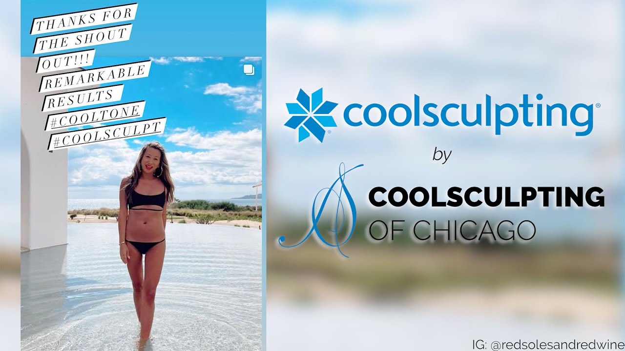 CoolSculpting by CoolSculpting of Chicago