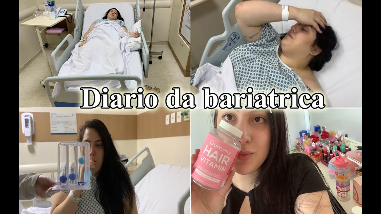 VLOG DA MINHA CIRURGIA BARIÁTRICA - diário da bariátrica #3