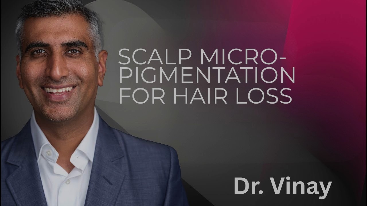 Scalp Micro-Pigmentation for hair loss