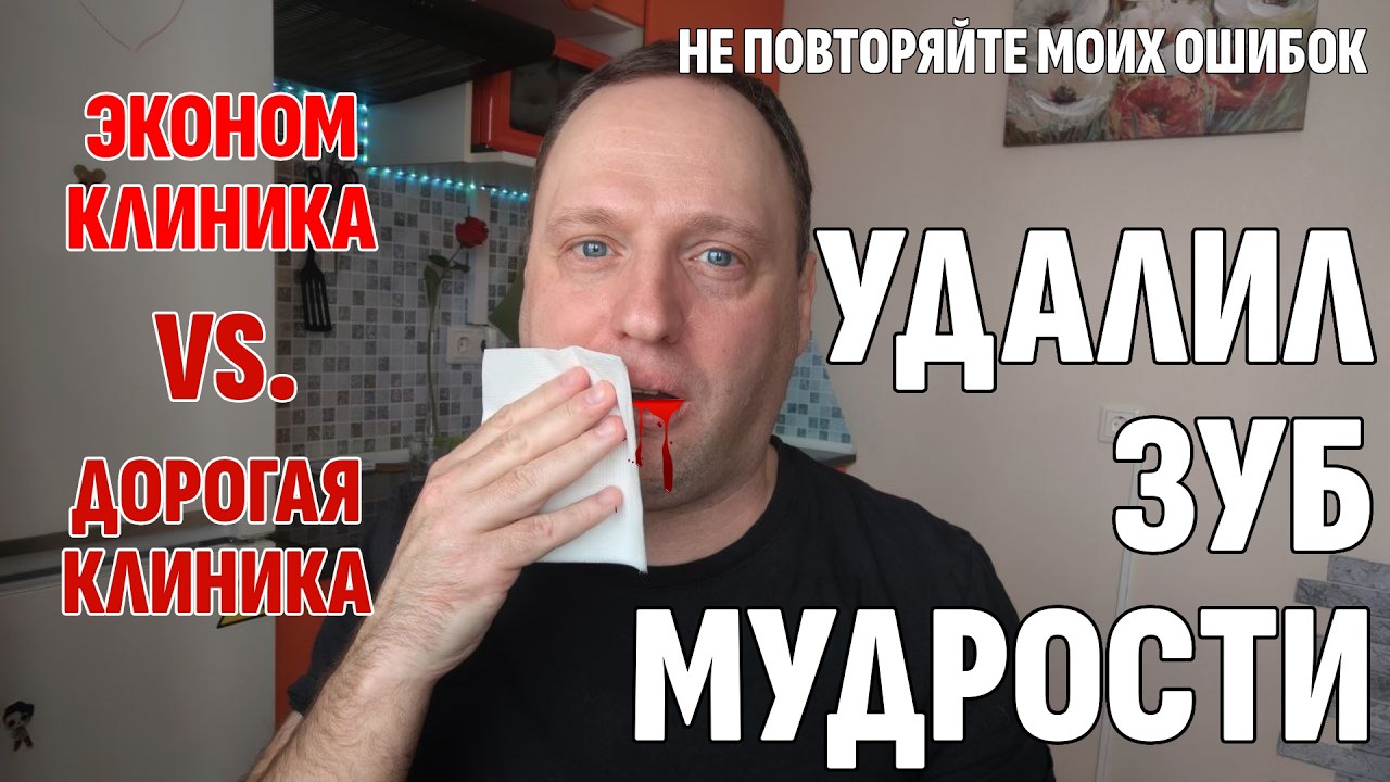 Удалил Зуб Мудрости в разных клиниках - И вот, что я понял | 40-летний холостяк