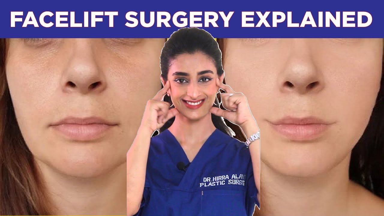 Facelift Explained By A Plastic Surgeon- Dr. Hirra Alavi