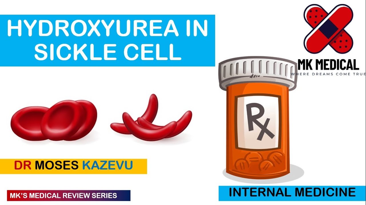 Hydroxyurea in Sickle cell