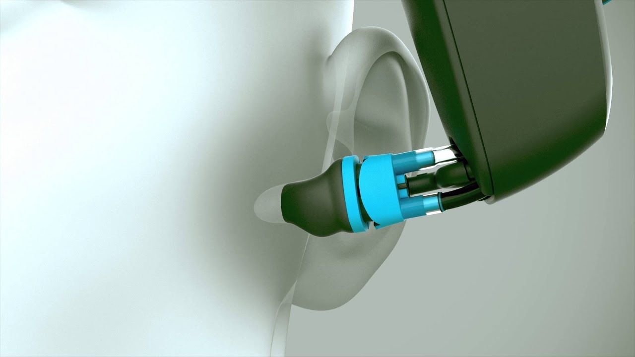 The SonoLab System