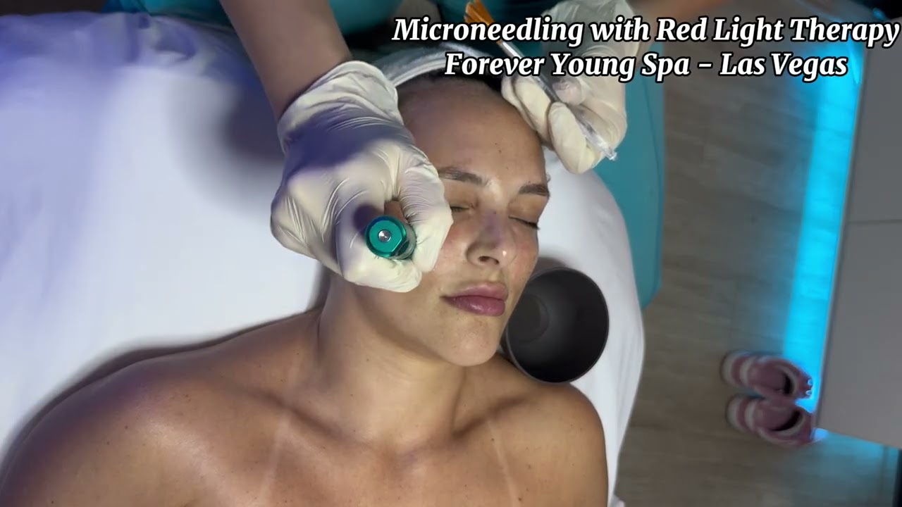 Microneedling with red light therapy
