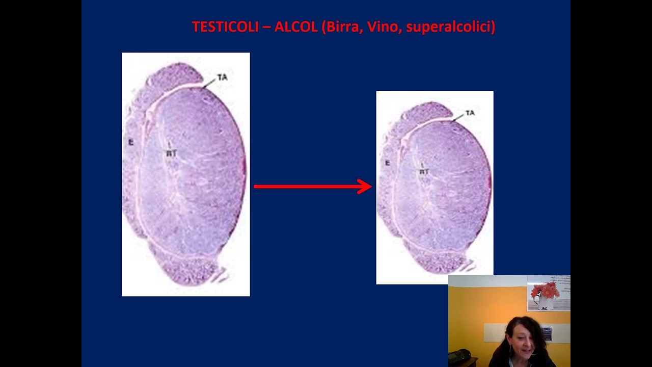 Dipendenza da alcool e patologie correlate - Corso scuola 