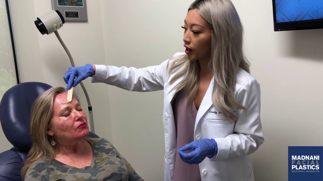 Post Laser Treatment Care