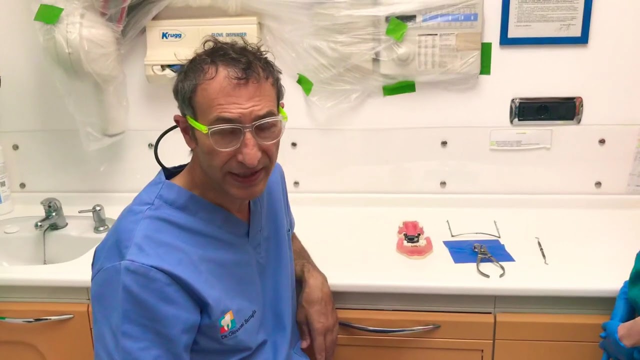 Montare una diga in endodonzia in 15 secondi