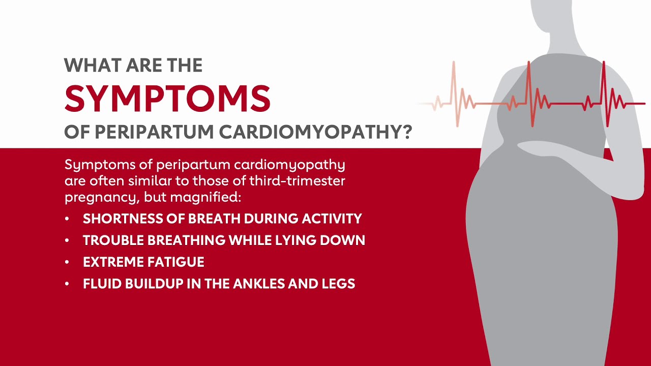Peripartum Cardiomyopathy Animation