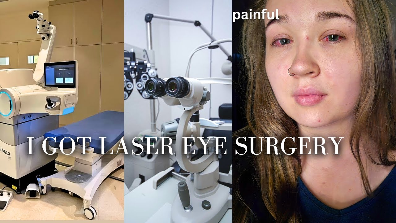 I GOT LASER EYE SURGERY | my experience getting Lasik
