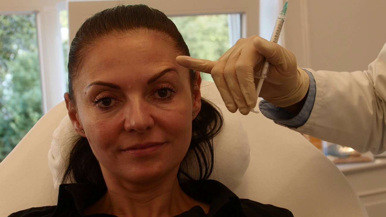 Die Behandlung mit Radiesse(R) & Belotero(R) - Zu Besuch bei Frau Bechtel in Hamburg