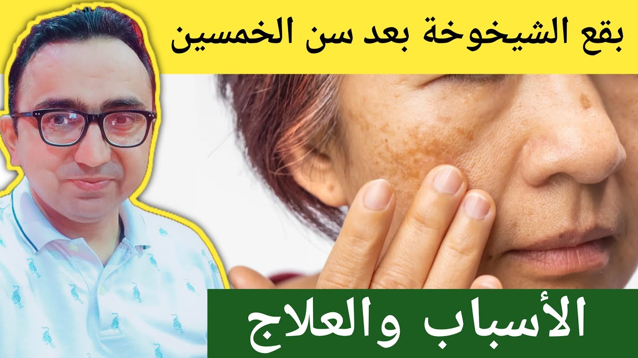 الأسباب الحقيقية لظهور بقع الشيخوخة وكيفية التخلص