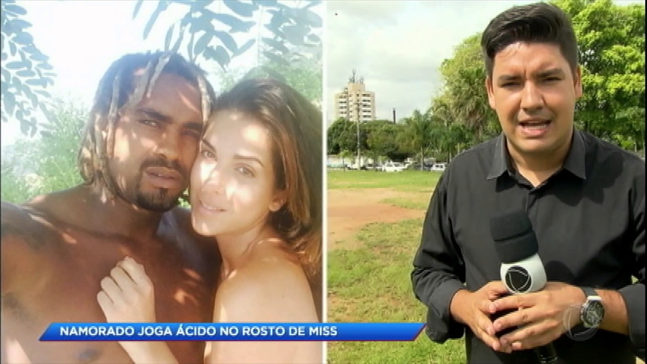 Namorado joga ácido no rosto de miss italiana