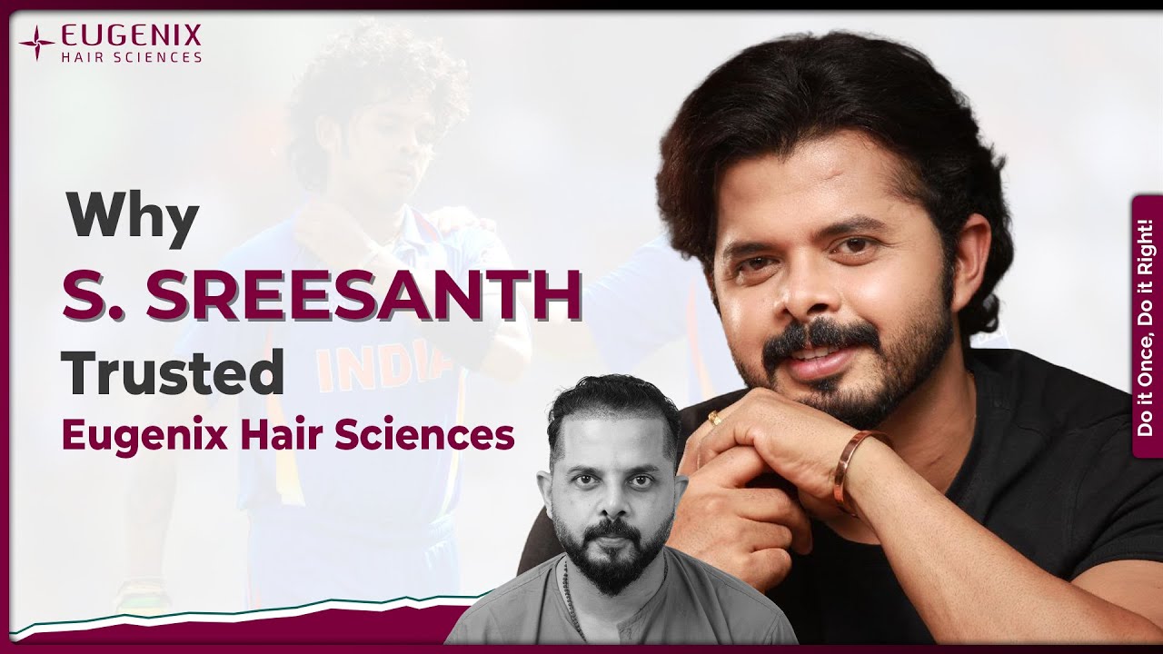 Cricket Star S. Sreesanth&rsquo;s Hair Transplant at Eugenix | Best Hair Transplant in India