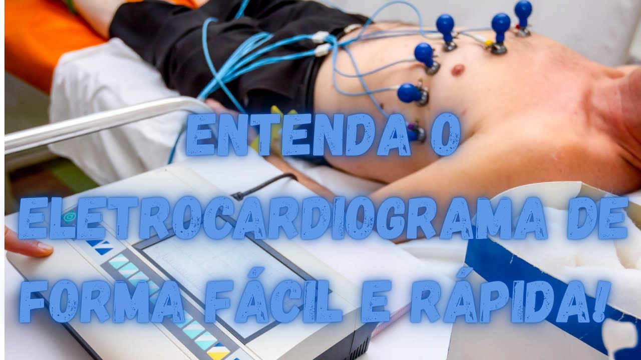 ENTENDA O ELETROCARDIOGRAMA DE FORMA FÁCIL E RÁPIDA.