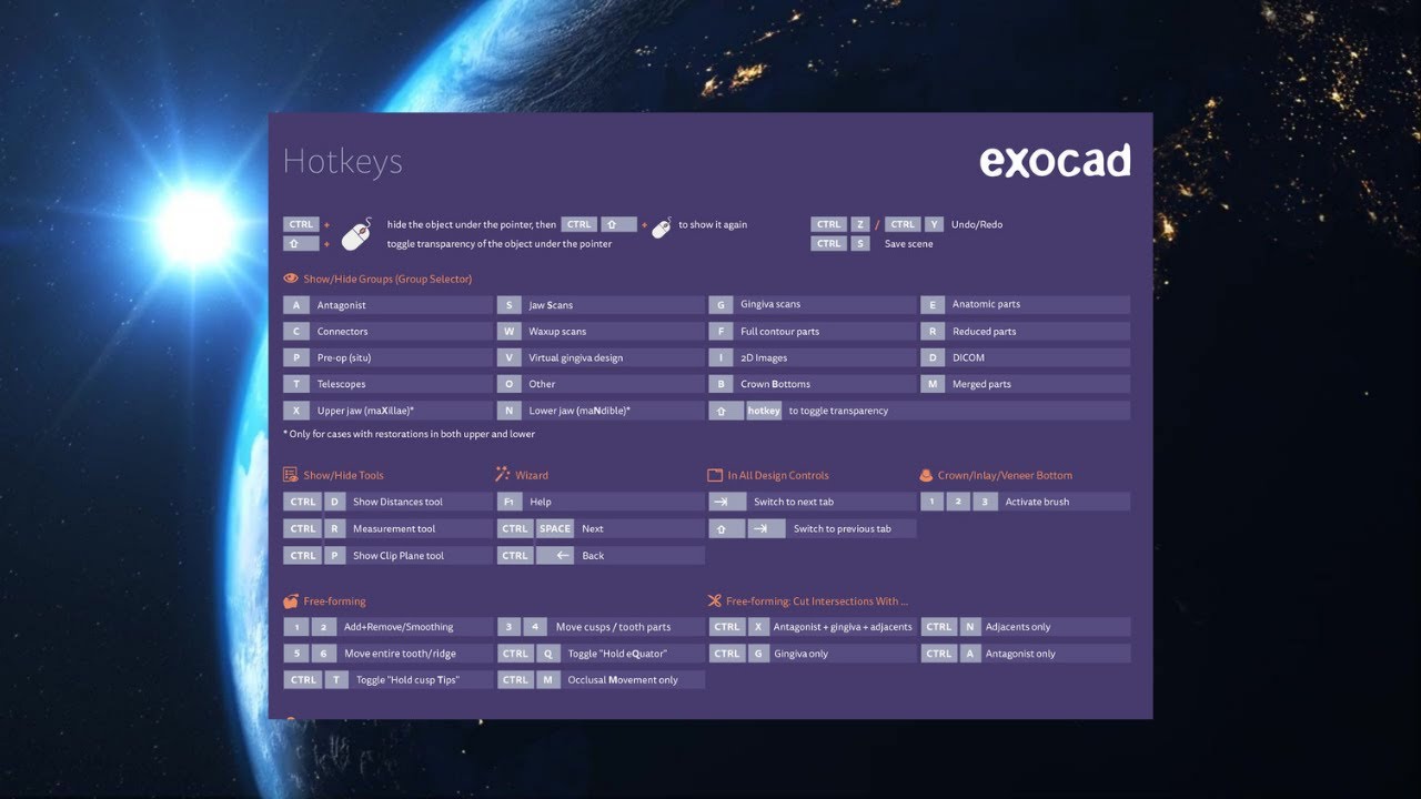 Most important shortcuts in Exocad