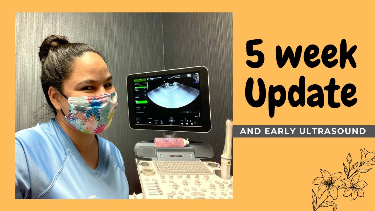 5 week pregnancy update & early ultrasound | My Surrogacy Journey
