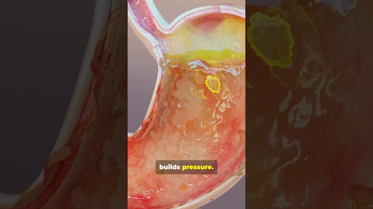Why Soda Makes You Burp 🥤💨 #shorts